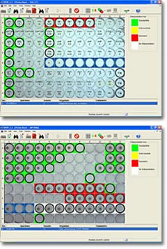 Vizion System
